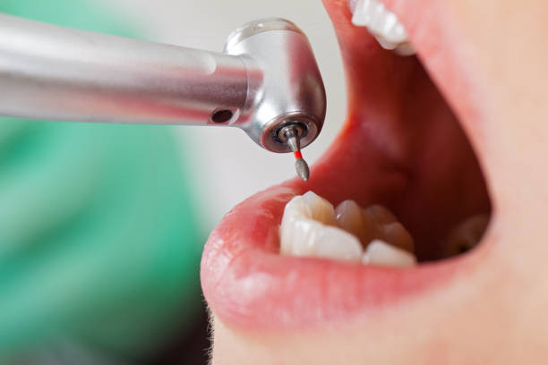 Best Cosmetic Emergency Dentistry in Newburgh Heights, OH
